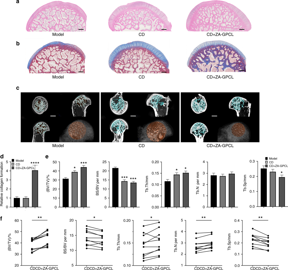 An injectable self-adaptive polymer as a drug carrier for the treatment of  nontraumatic early-stage osteonecrosis of the femoral head | Bone Research