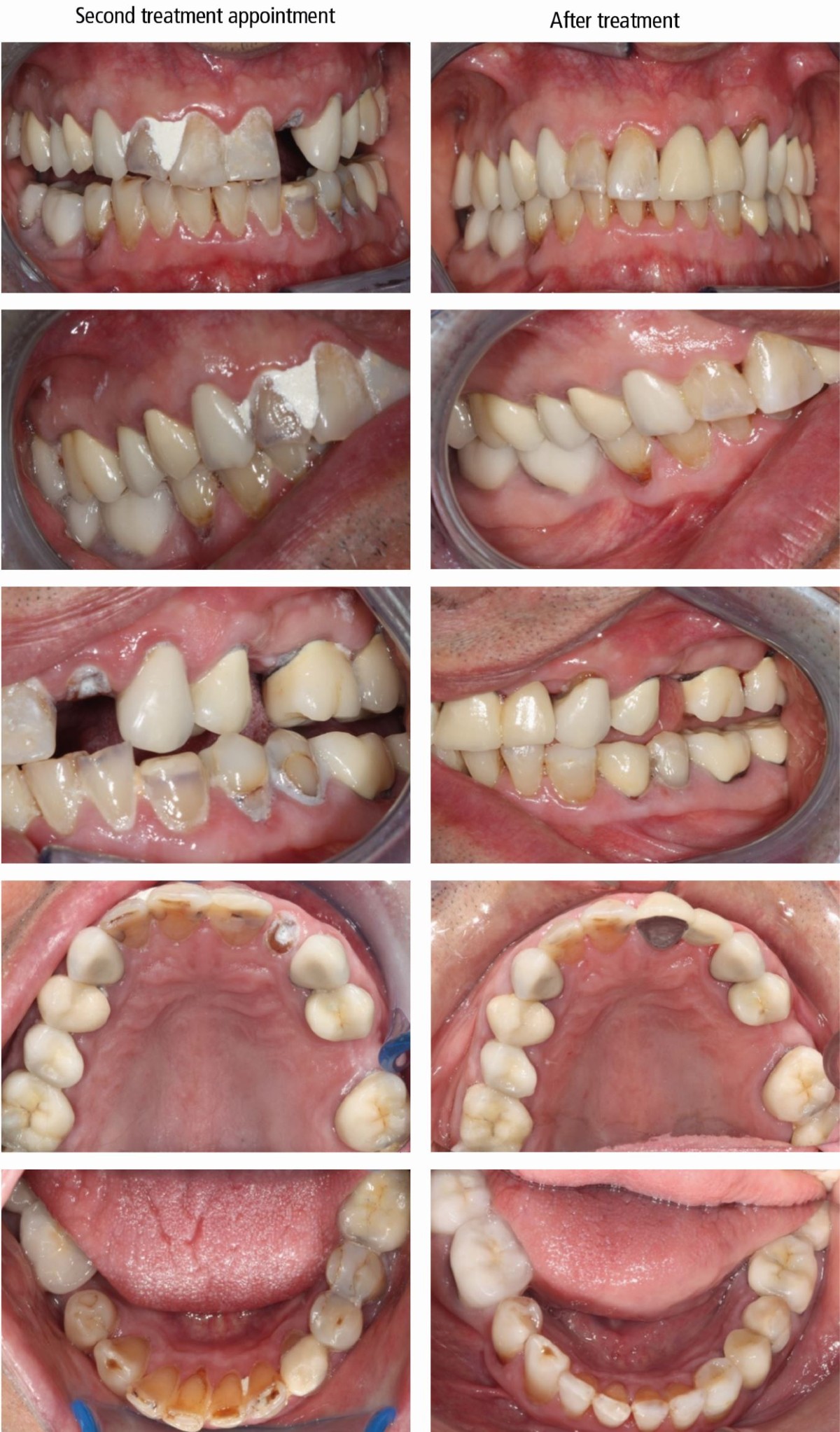 Dentistry and Parkinson's disease: learnings from two case reports ...