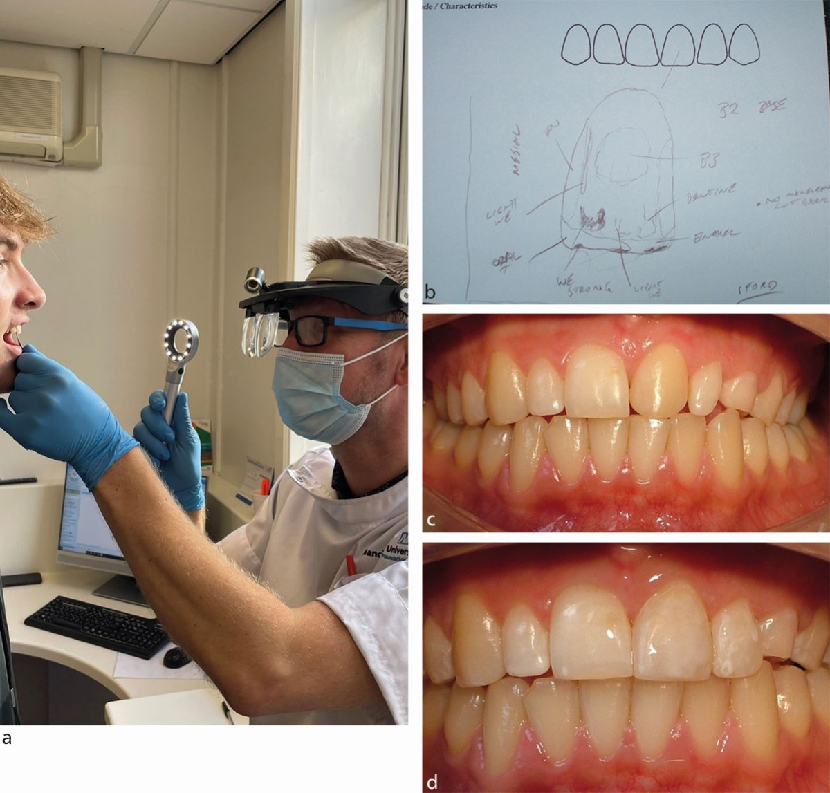 The Untold Secret To orthodontic braces treatment Dwarka In Less Than Ten Minutes