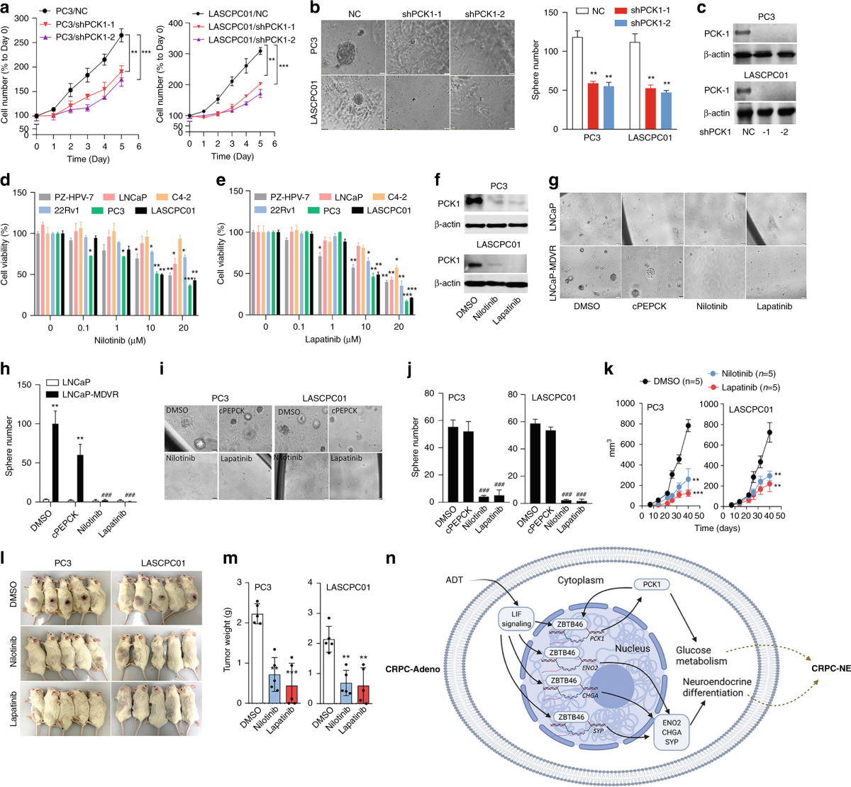 PCK1 regulates neuroendocrine differentiation in a positive feedback loop  of LIF/ZBTB46 signalling in castration-resistant prostate cancer | British  Journal of Cancer
