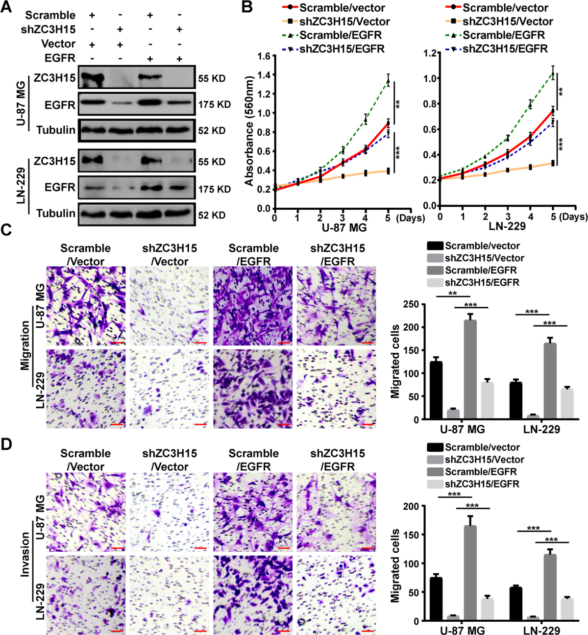 ZC3H15 promotes glioblastoma progression through regulating EGFR stability  | Cell Death & Disease