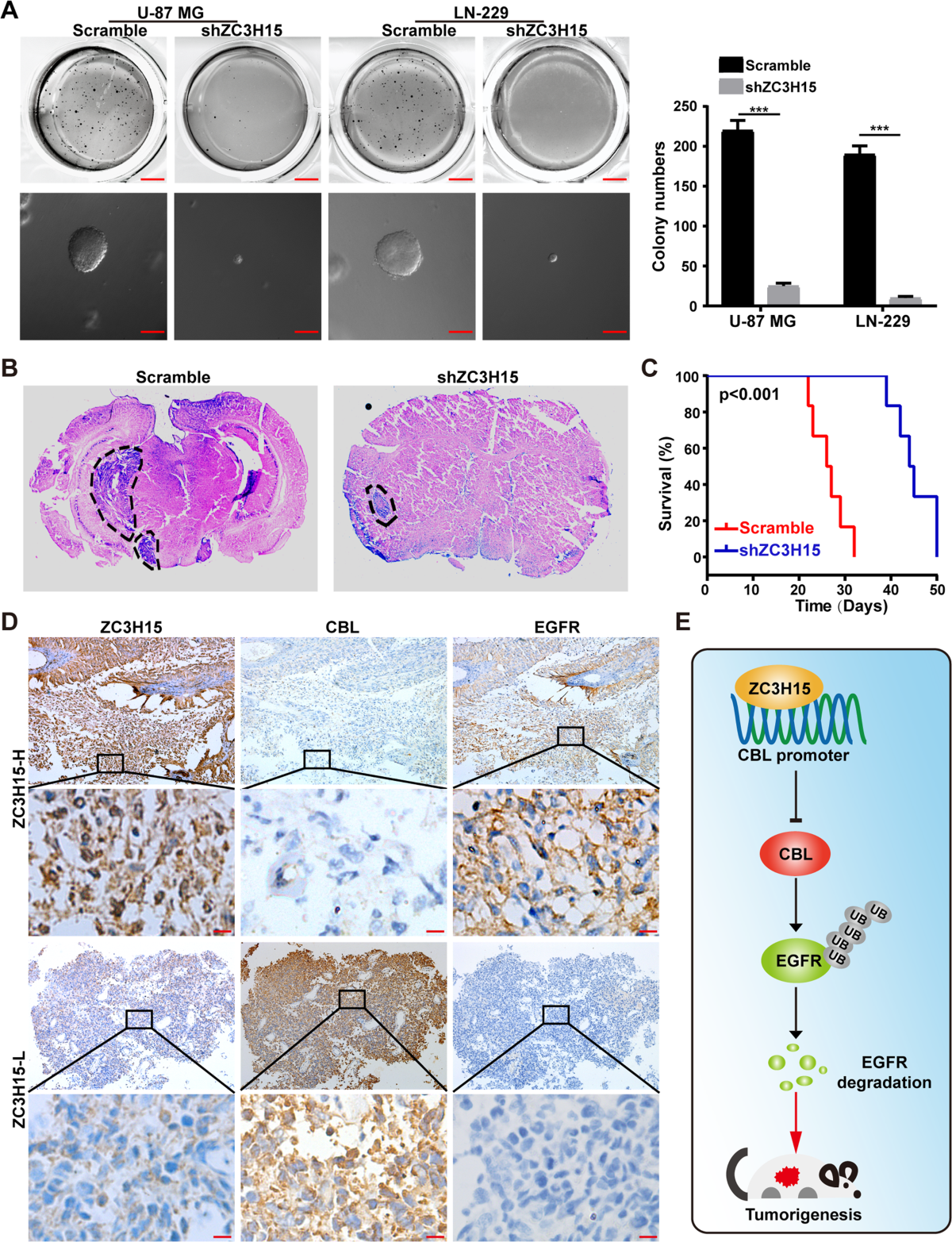 ZC3H15 promotes glioblastoma progression through regulating EGFR stability  | Cell Death & Disease