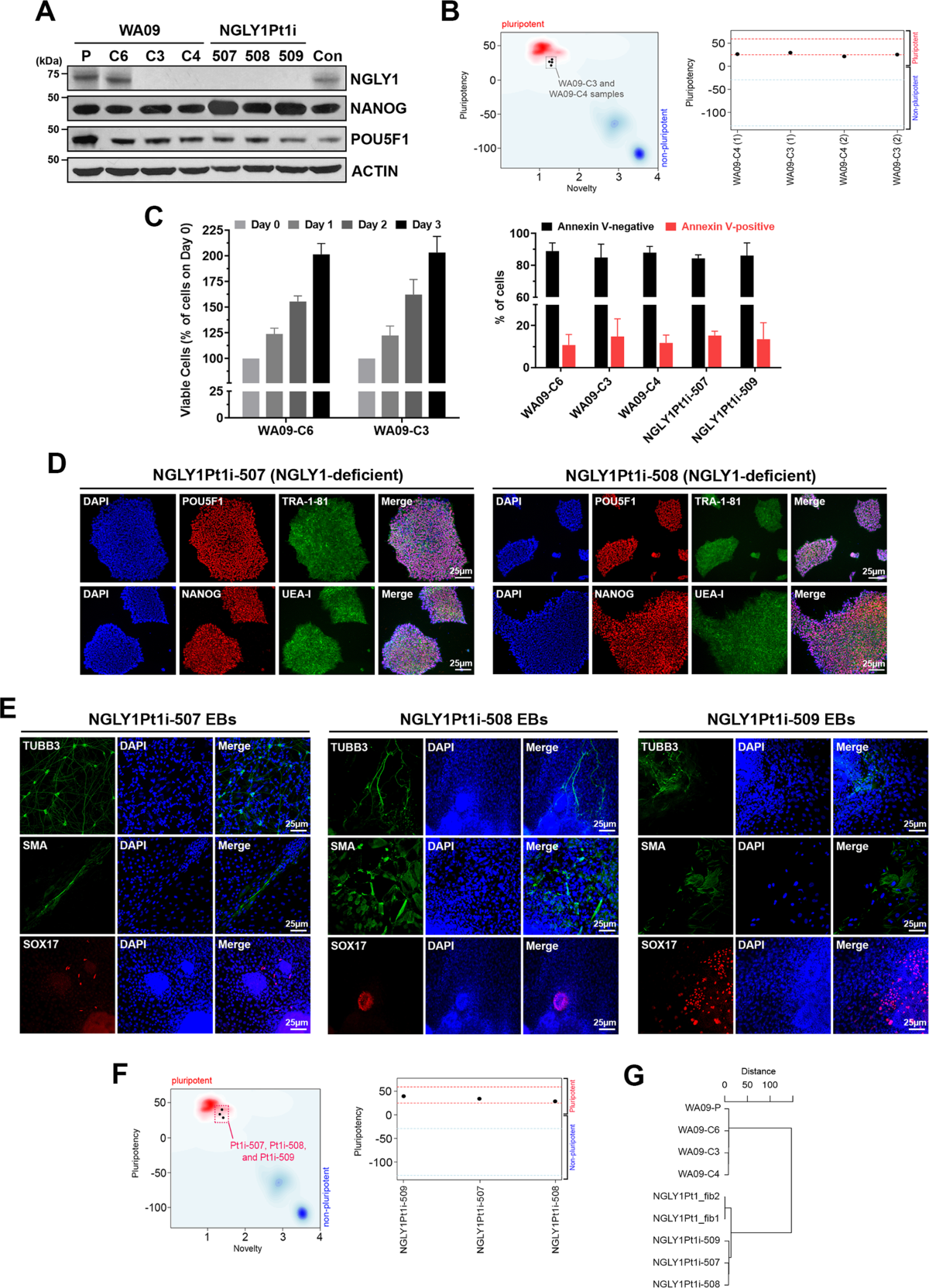 deficiency-of-n-glycanase-1-perturbs-neurogenesis-and-cerebral-development-modeled-by-human-organoids-cell-death-disease