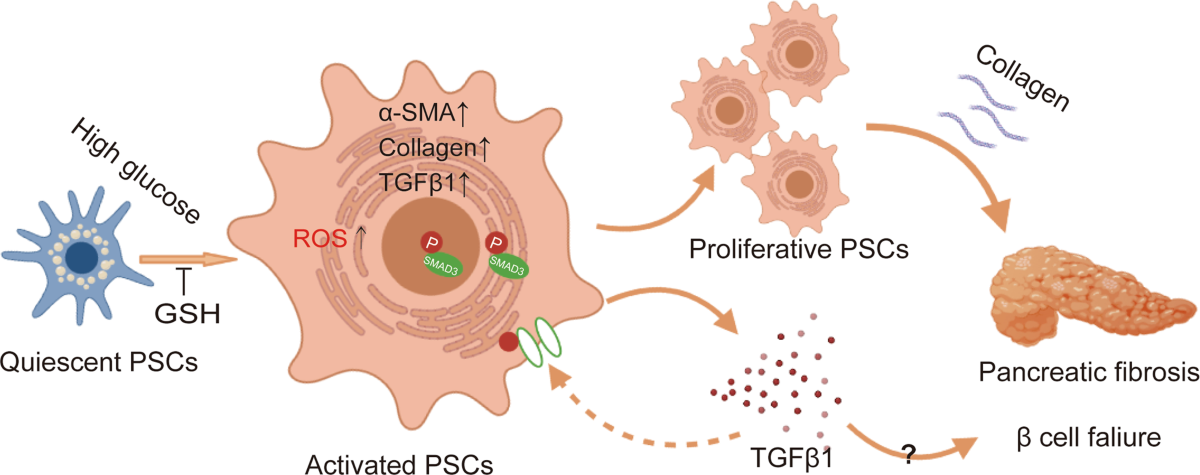Glutathione prevents high glucose-induced pancreatic fibrosis by suppressing pancreatic stellate cell activation via the ROS/TGF/SMAD pathway | Cell Death & Disease Glutathione prevents high glucose-induced pancreatic fibrosis by suppressing pancreatic stellate cell activation via the ROS/TGF/SMAD pathway | Cell Death & Disease