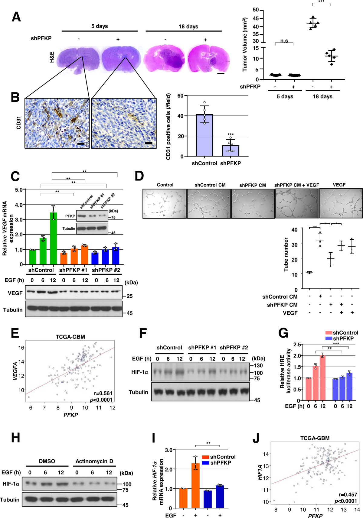 Mutual regulation between phosphofructokinase 1 platelet isoform and VEGF  promotes glioblastoma tumor growth | Cell Death & Disease