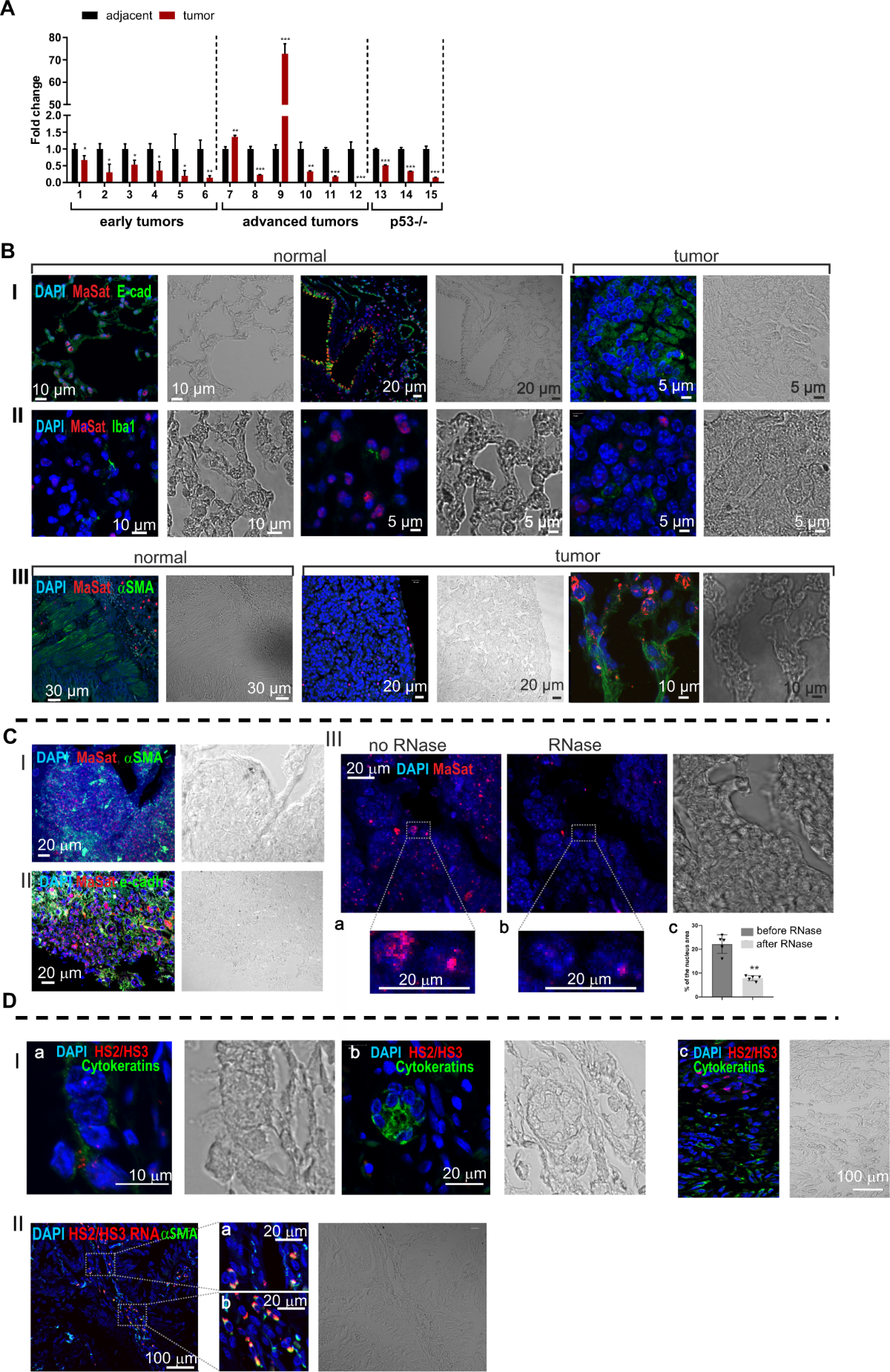 Pericentromeric satellite lncRNAs are induced in cancer-associated  fibroblasts and regulate their functions in lung tumorigenesis | Cell Death  & Disease