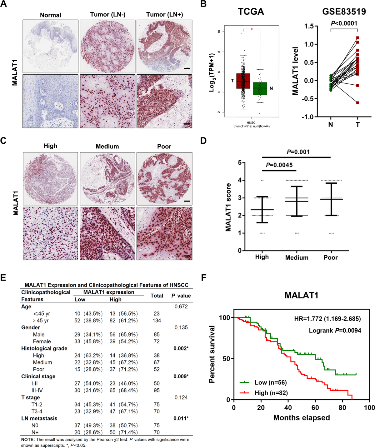 ls bd nude models LncRNA MALAT1 promotes growth and metastasis of head and neck squamous cell  carcinoma by repressing VHL through a non-canonical function of EZH2 | Cell  Death & Disease