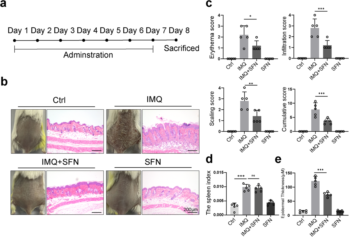 Sulforaphane alleviates psoriasis by enhancing antioxidant defense through KEAP1-NRF2 Pathway activation and attenuating inflammatory signaling | Cell Death & Disease Sulforaphane alleviates psoriasis by enhancing antioxidant defense through KEAP1-NRF2 Pathway activation and attenuating inflammatory signaling | Cell Death & Disease