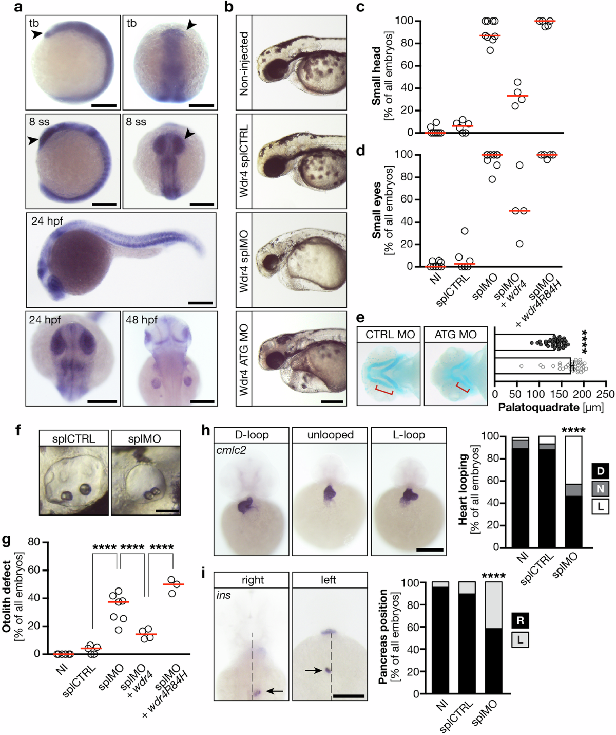 cilia-defects-upon-loss-of-wdr4-are-linked-to-proteasomal-hyperactivity-and-ubiquitin-shortage-cell-death-disease