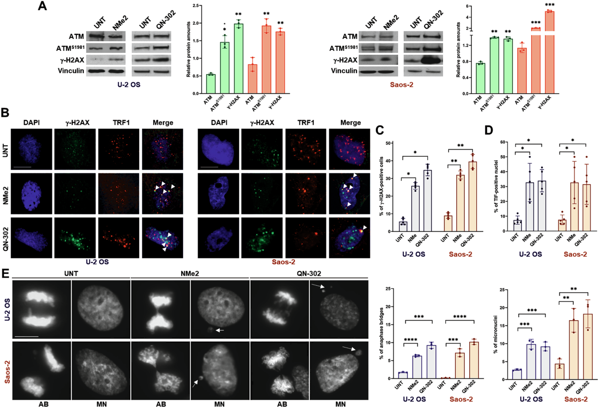 Cellular adaptations impact the biological activity of naphthalene diimide  G-quadruplex ligands in ALT-positive osteosarcoma cells | Cell Death &  Disease