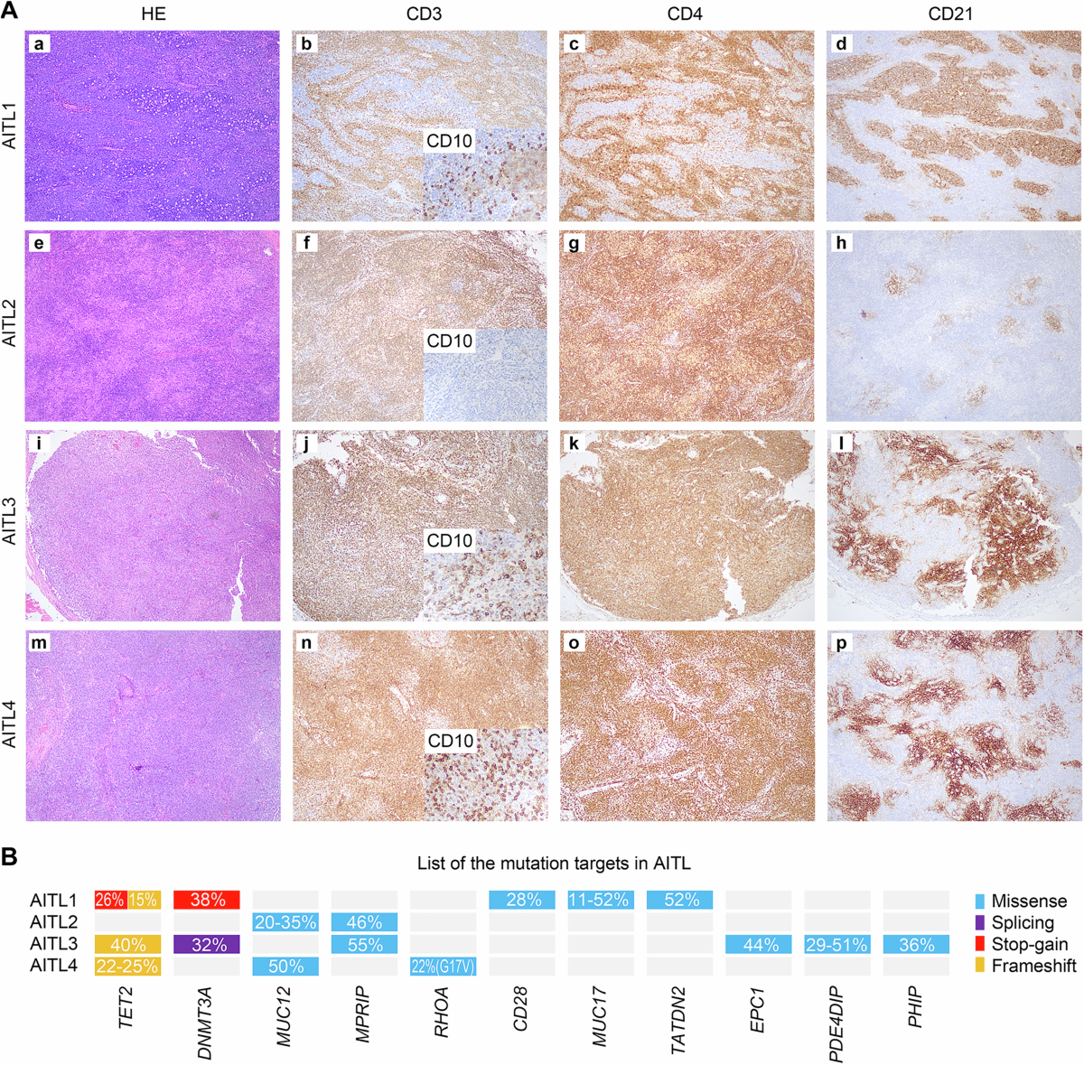 Revealing tumor microenvironmental heterogeneity and prognostic value in  angioimmunoblastic T-cell lymphoma via spatial transcriptome sequencing |  Cell Death & Disease