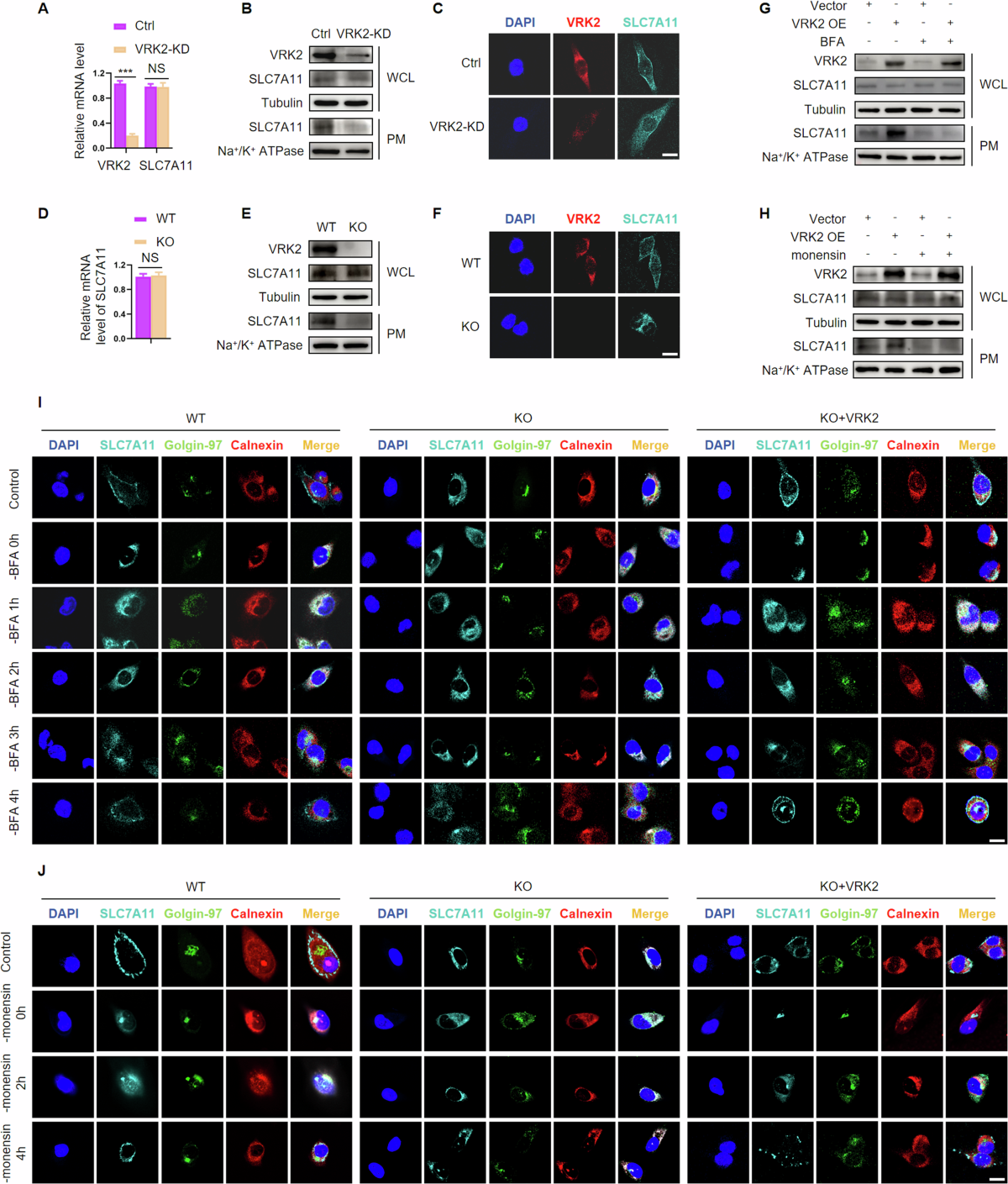Vaccinia-related kinase 2 inhibition elicits vulnerability of glutathione  metabolism in pancreatic cancer
