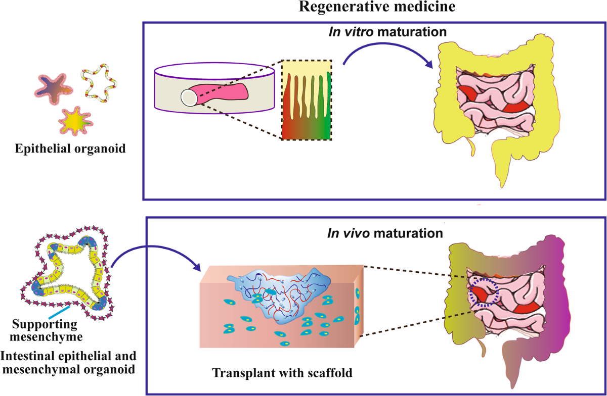Stem cell-derived intestinal organoids: a novel modality for IBD | Cell Death Discovery