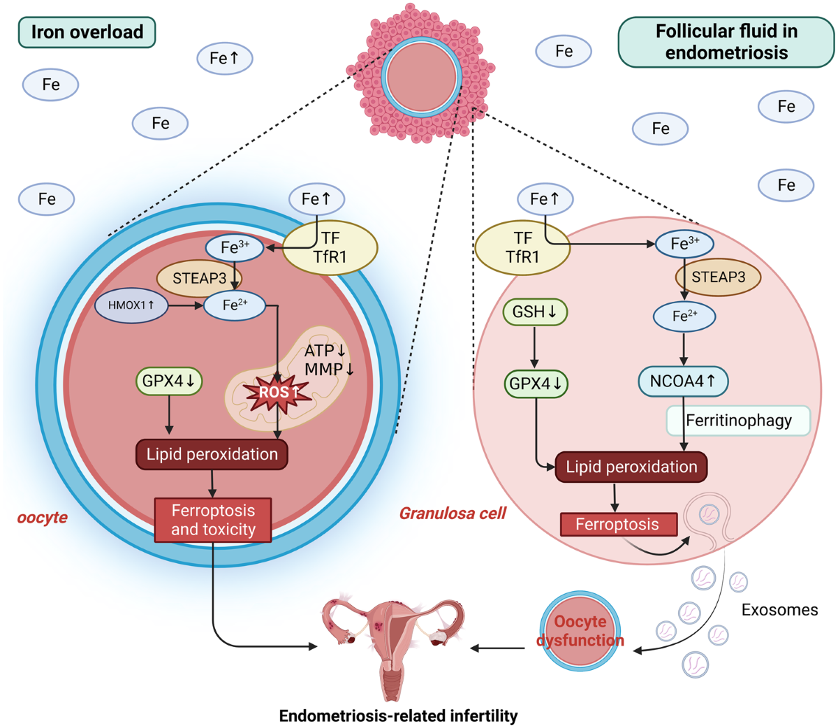 does glutathione help endometriosis Double-edged roles of ferroptosis in endometriosis and endometriosis-related  infertility