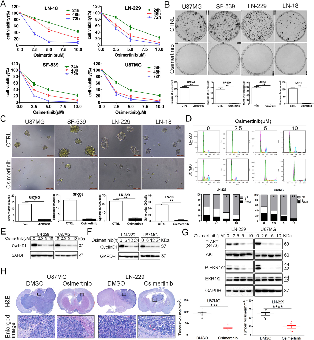 Osimertinib induces paraptosis and TRIP13 confers resistance in glioblastoma cells | Cell Death Discovery osimertinib-induces-paraptosis-and-trip13-confers-resistance-in-glioblastoma-cells-cell-death-discovery