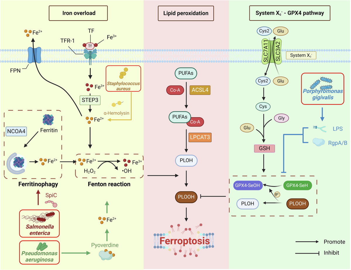 Ferroptosis in periodontitis: mechanisms, impacts, and systemic connections | Cell Death Discovery Ferroptosis in periodontitis: mechanisms, impacts, and systemic connections | Cell Death Discovery