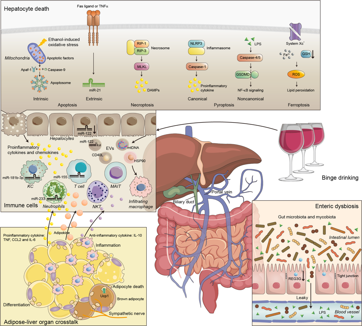 effect of glutathione on fatty liver Immunological mechanisms and therapeutic targets of fatty liver diseases