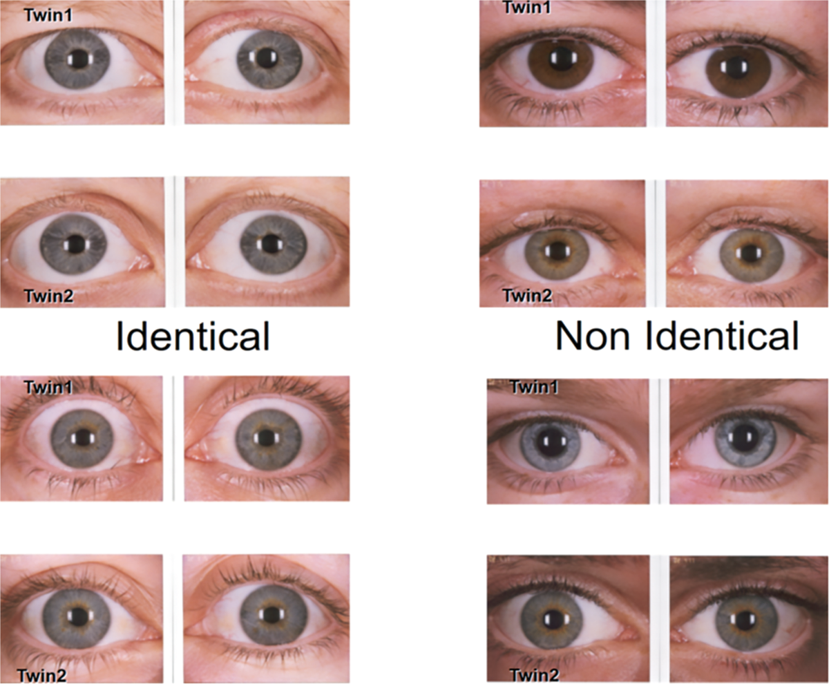 What colour are your eyes? Teaching the genetics of eye colour 