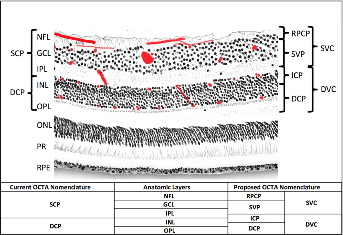 The role of the retinal vasculature in age-related macular degeneration: a  spotlight on OCTA | Eye