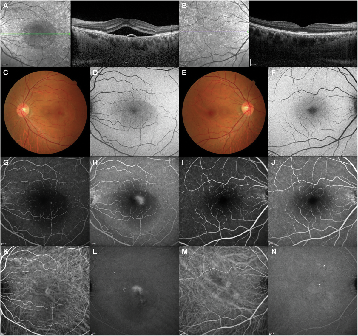 Miranda Kerr Model - Victoria Secret Angel Poses