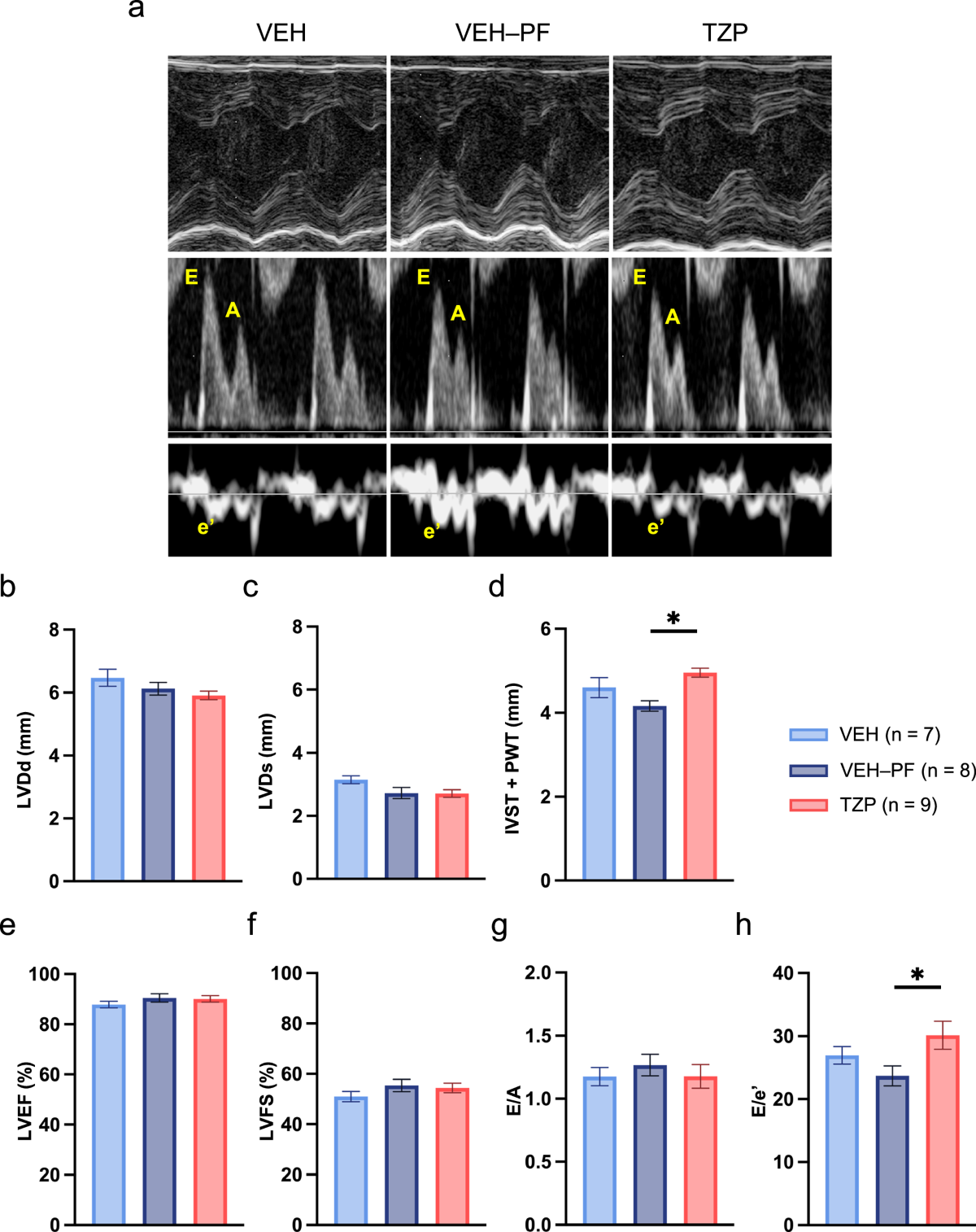 tirzepatide and increased heart rate Effects of tirzepatide, a dual GIP and GLP-1 receptor agonist, on blood  pressure, cardiac function, and sympathetic nervous system in stroke-prone  spontaneously hypertensive rats