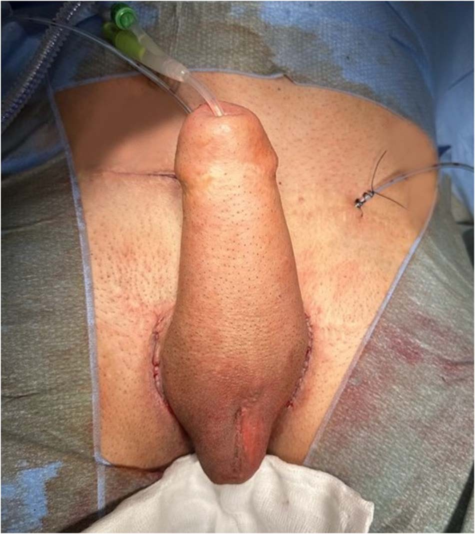 shemale with erection 