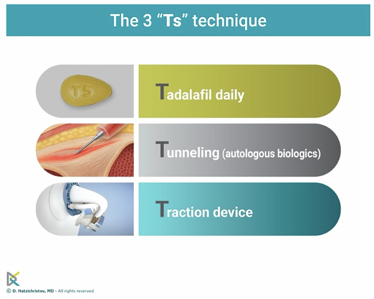 peyronie's forum acetyl l carnitine 2018 From fibrosis to restoration: the multimodal 3 Ts protocol for Peyronie's  disease