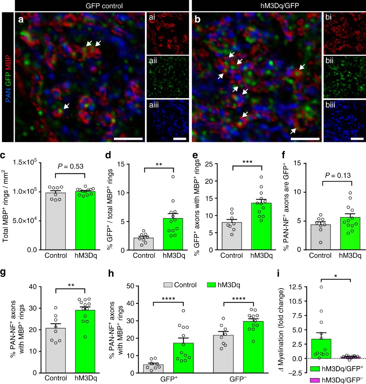 Pharmacogenetic stimulation of neuronal activity increases myelination in  an axon-specific manner | Nature Communications, image size:1200x1258