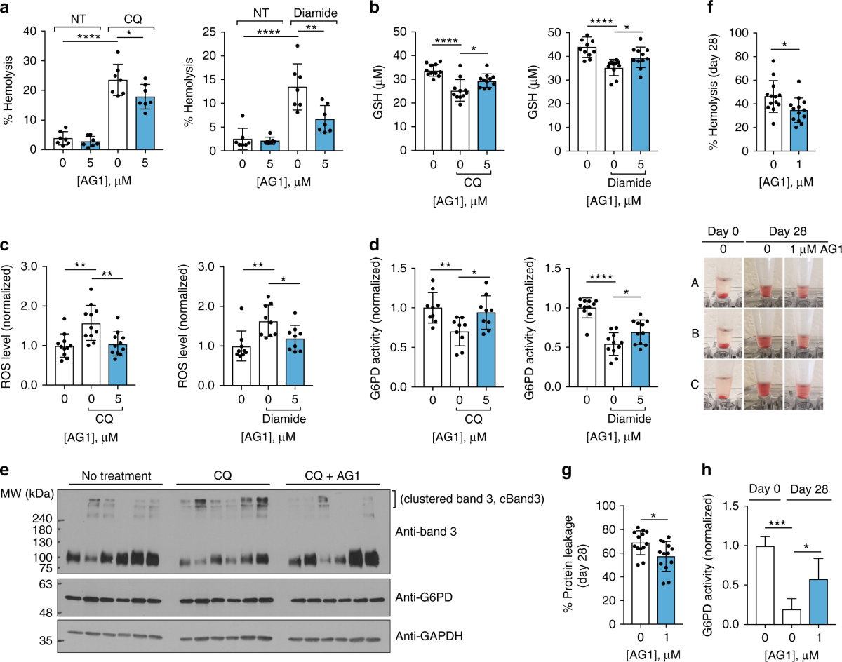 is glutathione safe for g6pd deficiency Correcting glucose-6-phosphate dehydrogenase deficiency with a  small-molecule activator