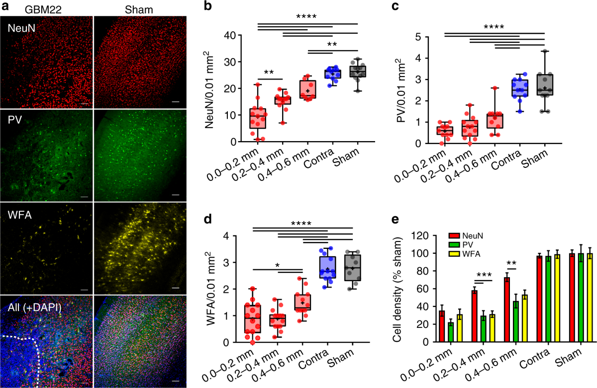 Perineuronal nets decrease membrane capacitance of peritumoral fast spiking  interneurons in a model of epilepsy | Nature Communications