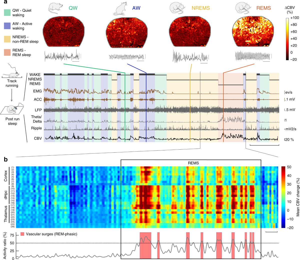 Local hippocampal fast gamma rhythms precede brain-wide hyperemic patterns  during spontaneous rodent REM sleep | Nature Communications