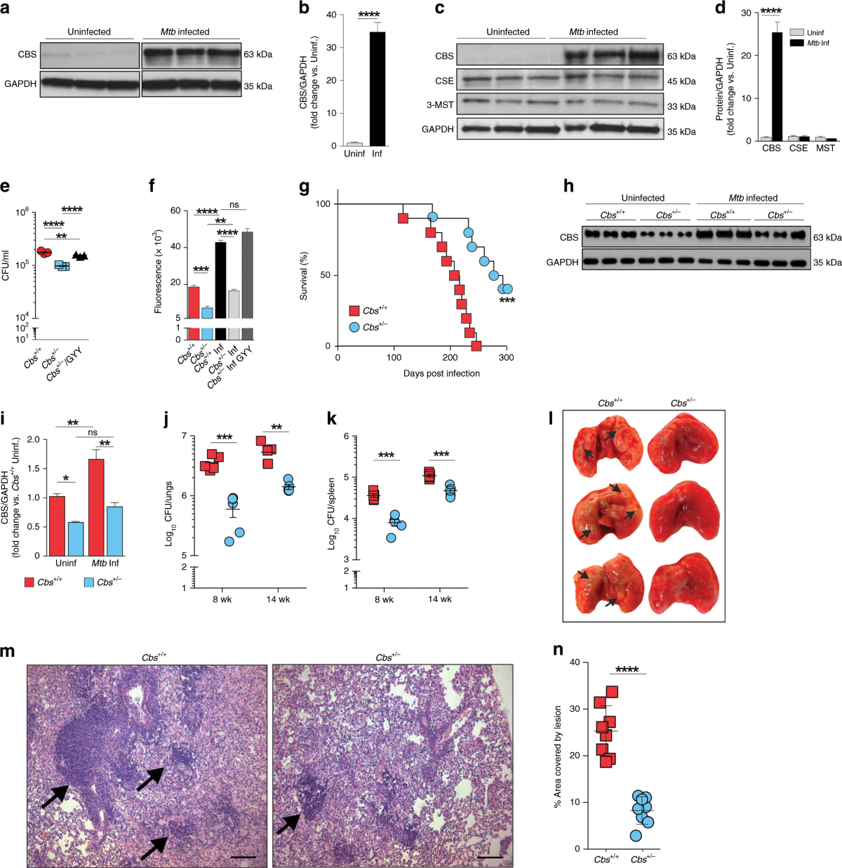 Hydrogen sulfide stimulates Mycobacterium tuberculosis respiration, growth and pathogenesis
