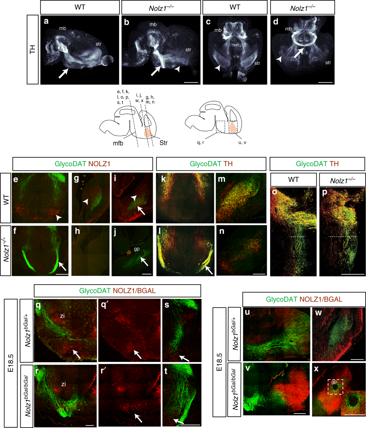 Nolz1 expression is required in dopaminergic axon guidance and striatal innervation | Nature Communications nolz1-expression-is-required-in-dopaminergic-axon-guidance-and-striatal-innervation-nature-communications