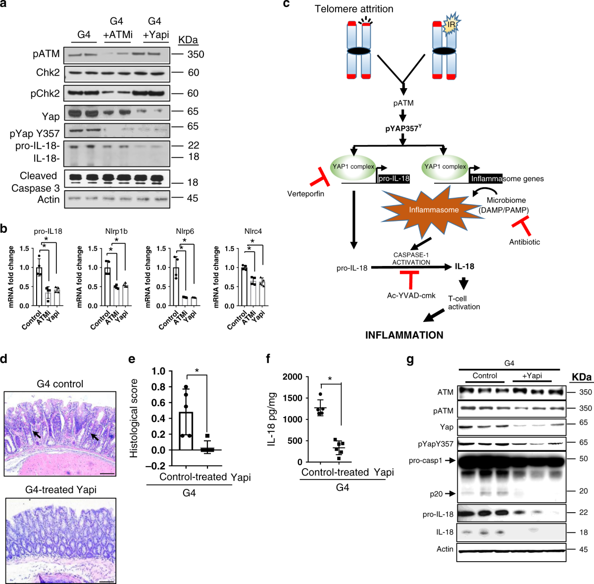 Telomere dysfunction activates YAP1 to drive tissue inflammation | Nature  Communications