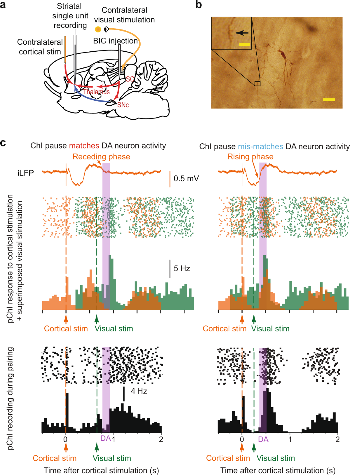 Coincidence of cholinergic pauses, dopaminergic activation and depolarisation of spiny projection neurons drives synaptic plasticity in the striatum | Nature Communications coincidence-of-cholinergic-pauses-dopaminergic-activation-and-depolarisation-of-spiny-projection-neurons-drives-synaptic-plasticity-in-the-striatum-nature-communications