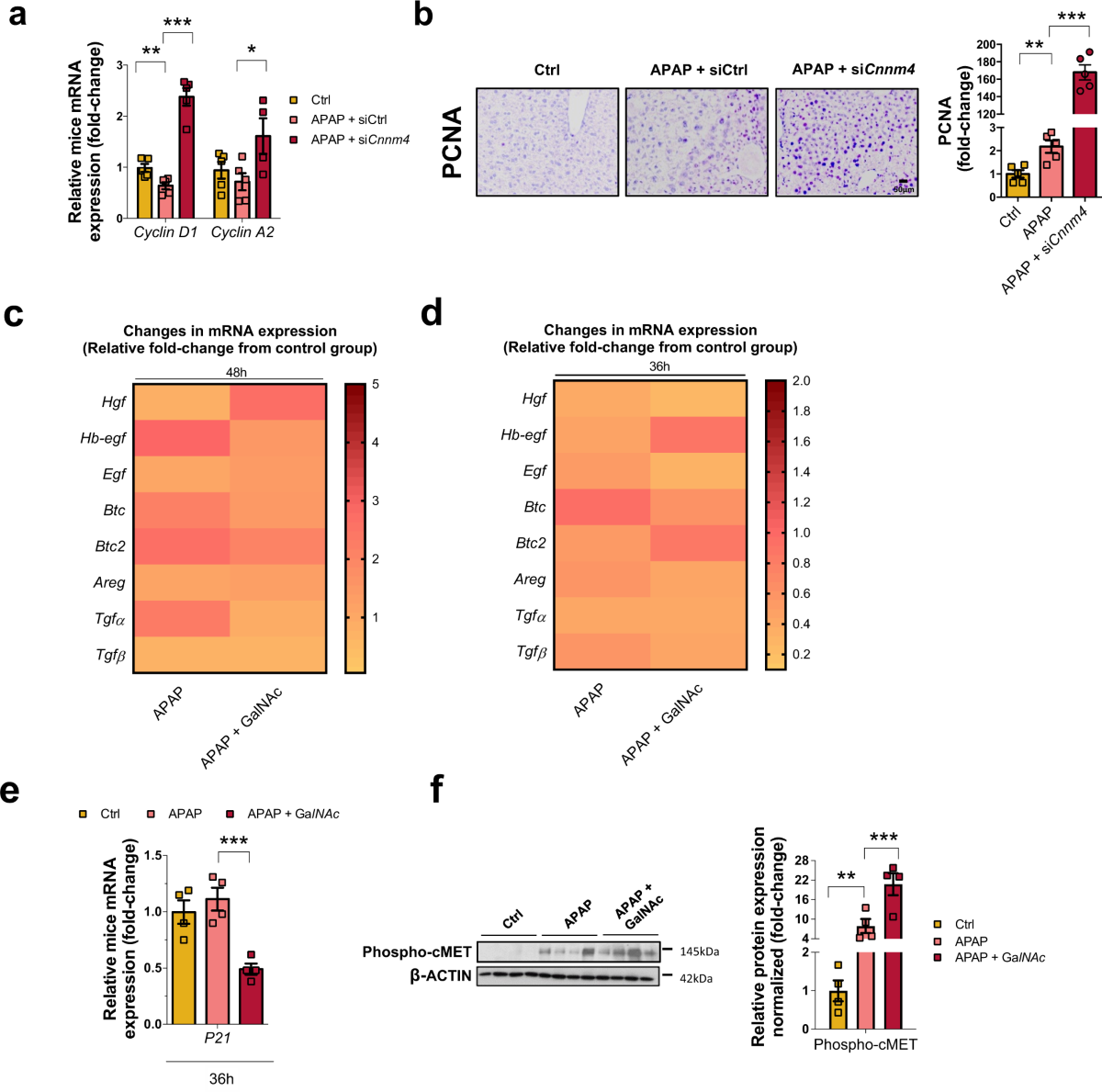 Restoring cellular magnesium balance through Cyclin M4 protects against  acetaminophen-induced liver damage | Nature Communications
