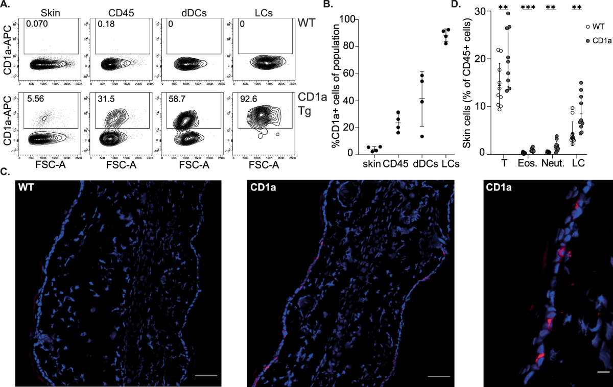 CD1a promotes systemic manifestations of skin inflammation