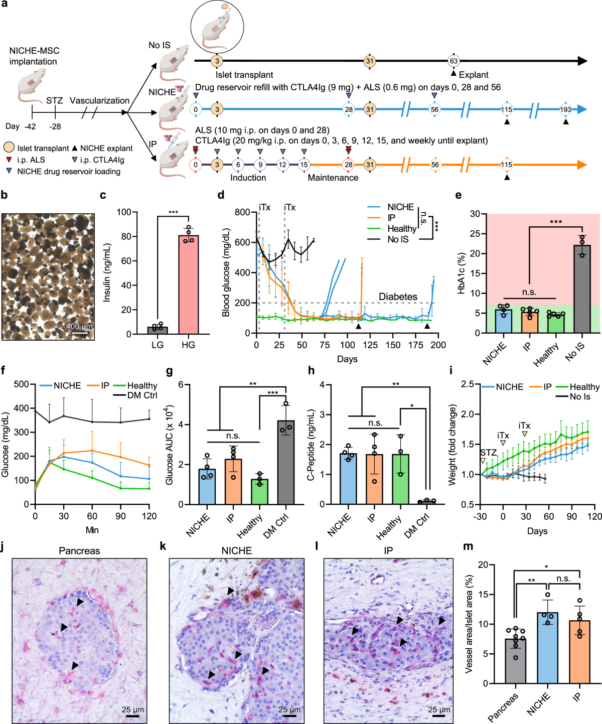 Implantable niche with local immunosuppression for islet  allotransplantation achieves type 1 diabetes reversal in rats | Nature  Communications