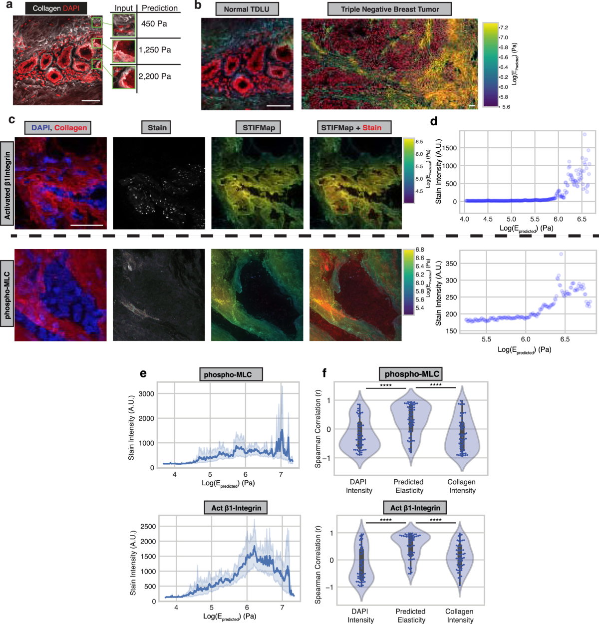 A convolutional neural network STIFMap reveals associations between stromal  stiffness and EMT in breast cancer | Nature Communications