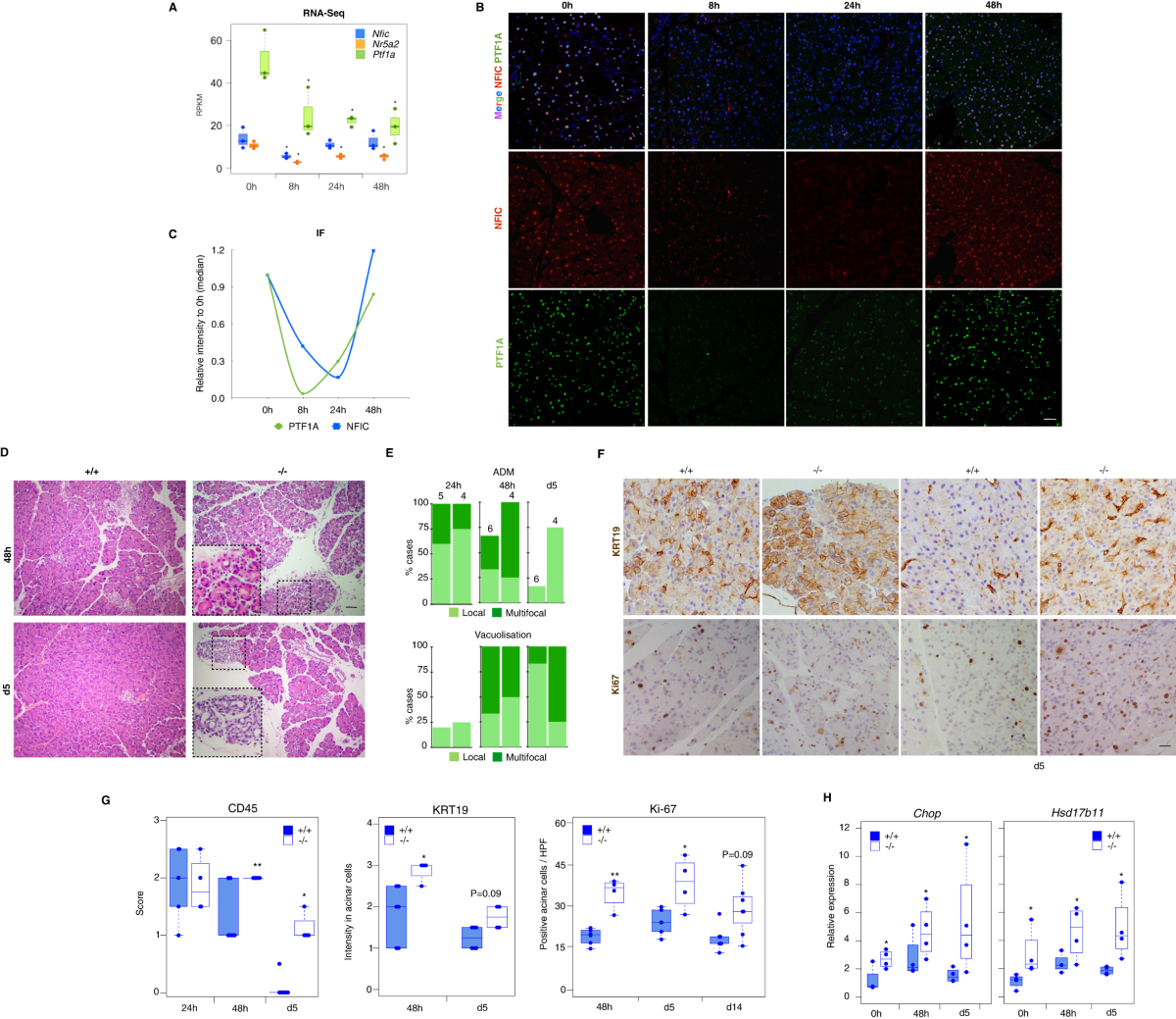 NFIC regulates ribosomal biology and ER stress in pancreatic acinar cells  and restrains PDAC initiation | Nature Communications