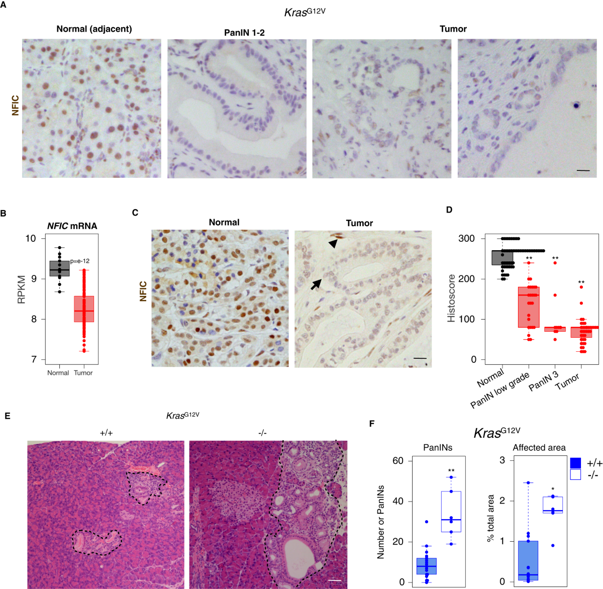 NFIC regulates ribosomal biology and ER stress in pancreatic acinar cells  and restrains PDAC initiation | Nature Communications