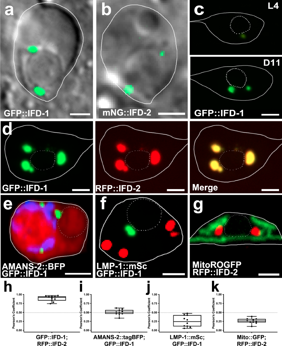 alms bio glutathione supplement Glutathione Depletion and Stalwart Anticancer Activity of  Metallotherapeutics Inducing Programmed Cell Death: Opening a New Window  for Cancer Therapy main image 1