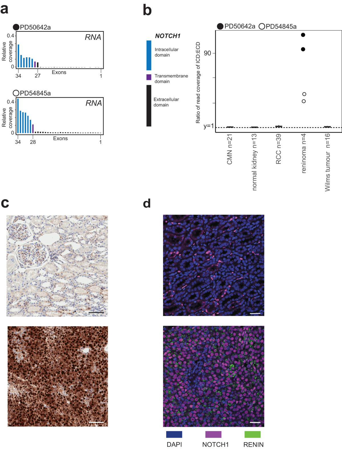 Targetable NOTCH1 rearrangements in reninoma | Nature Communications