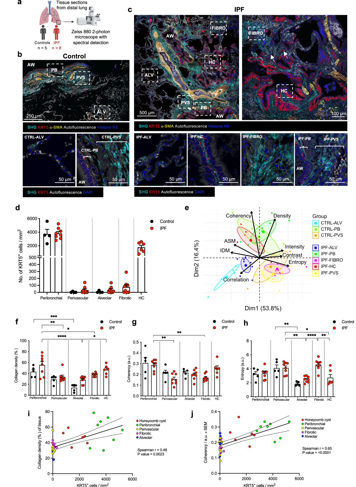 Lung extracellular matrix modulates KRT5+ basal cell activity in 