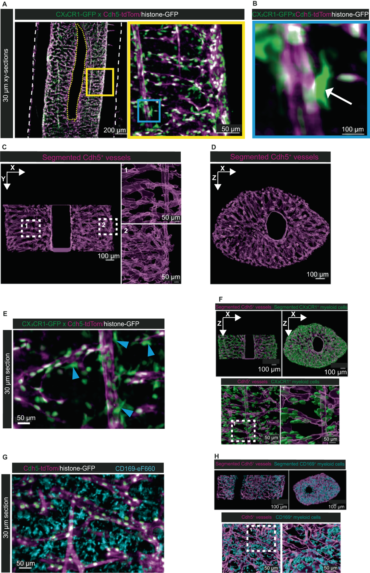 MarShie: a clearing protocol for 3D analysis of single cells throughout the  bone marrow at subcellular resolution | Nature Communications