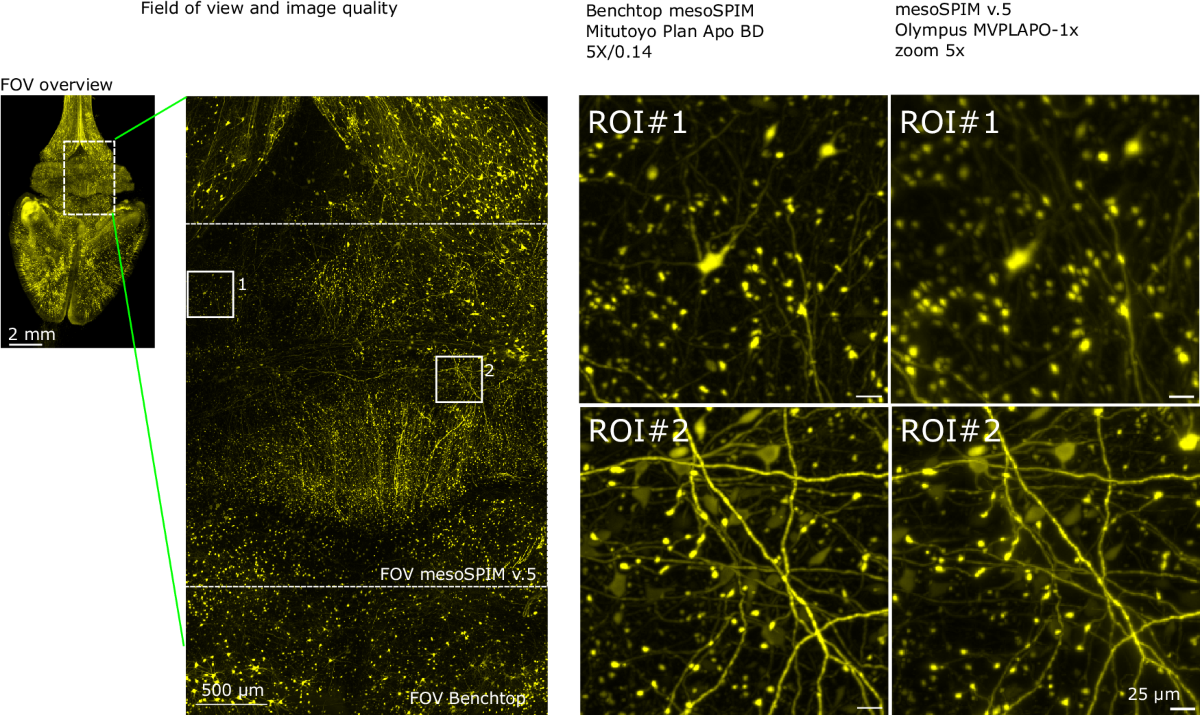 Benchtop mesoSPIM: a next-generation open-source light-sheet microscope for  cleared samples | Nature Communications