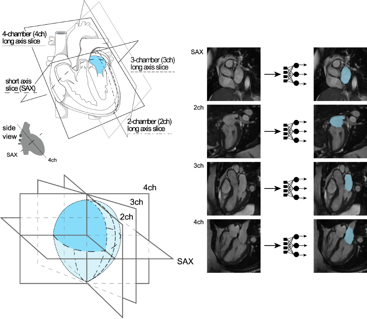 Deep learning of left atrial structure and function provides link to atrial  fibrillation risk | Nature Communications