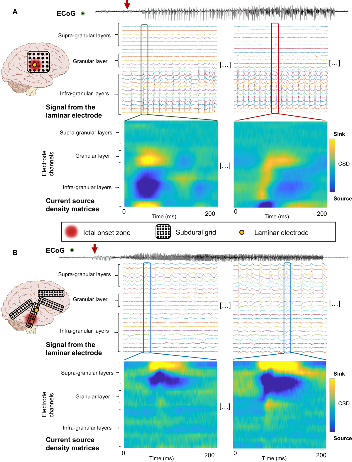 Differential cortical layer engagement during seizure initiation and spread  in humans | Nature Communications