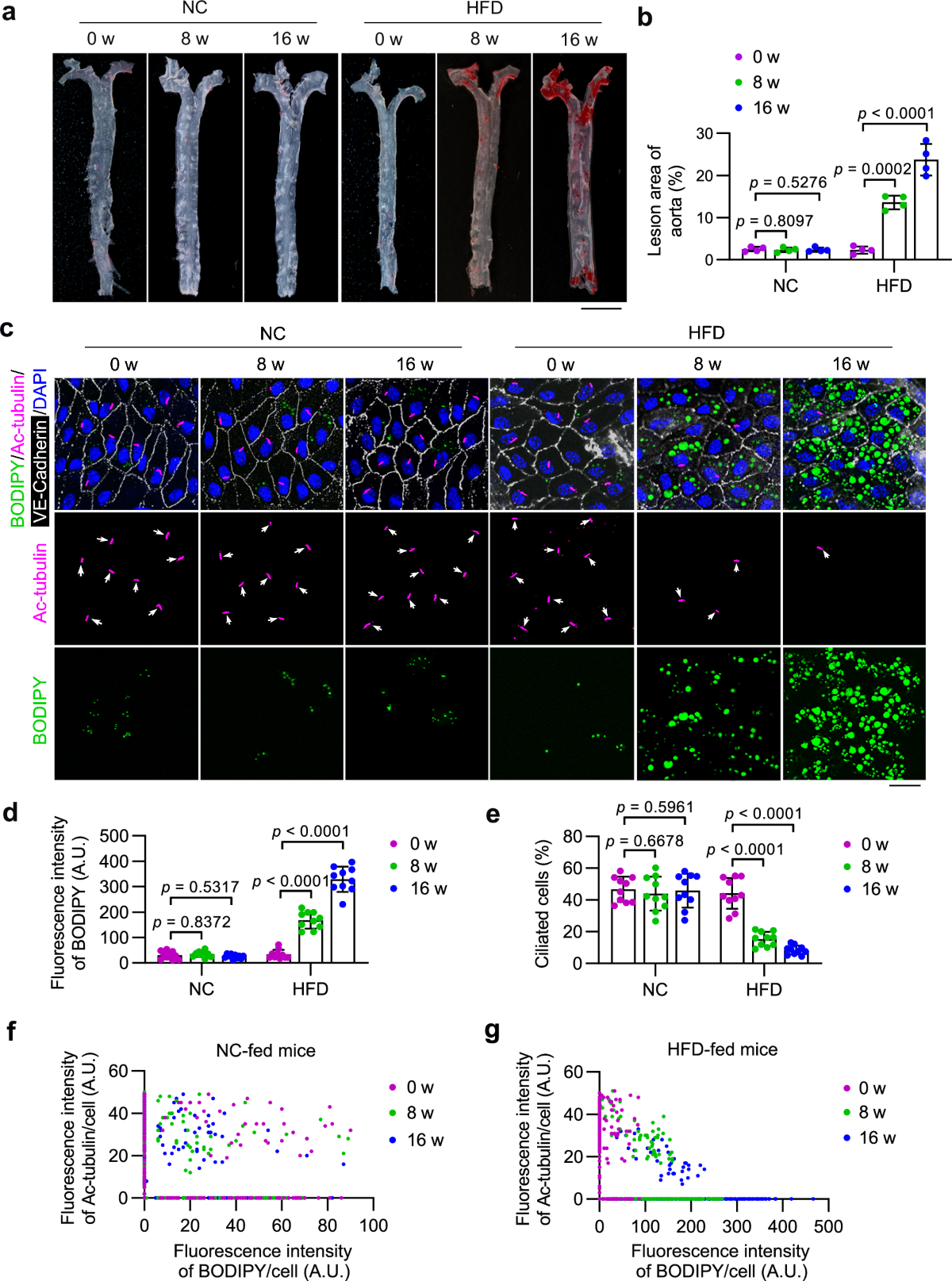 Lipid droplets sequester palmitic acid to disrupt endothelial 