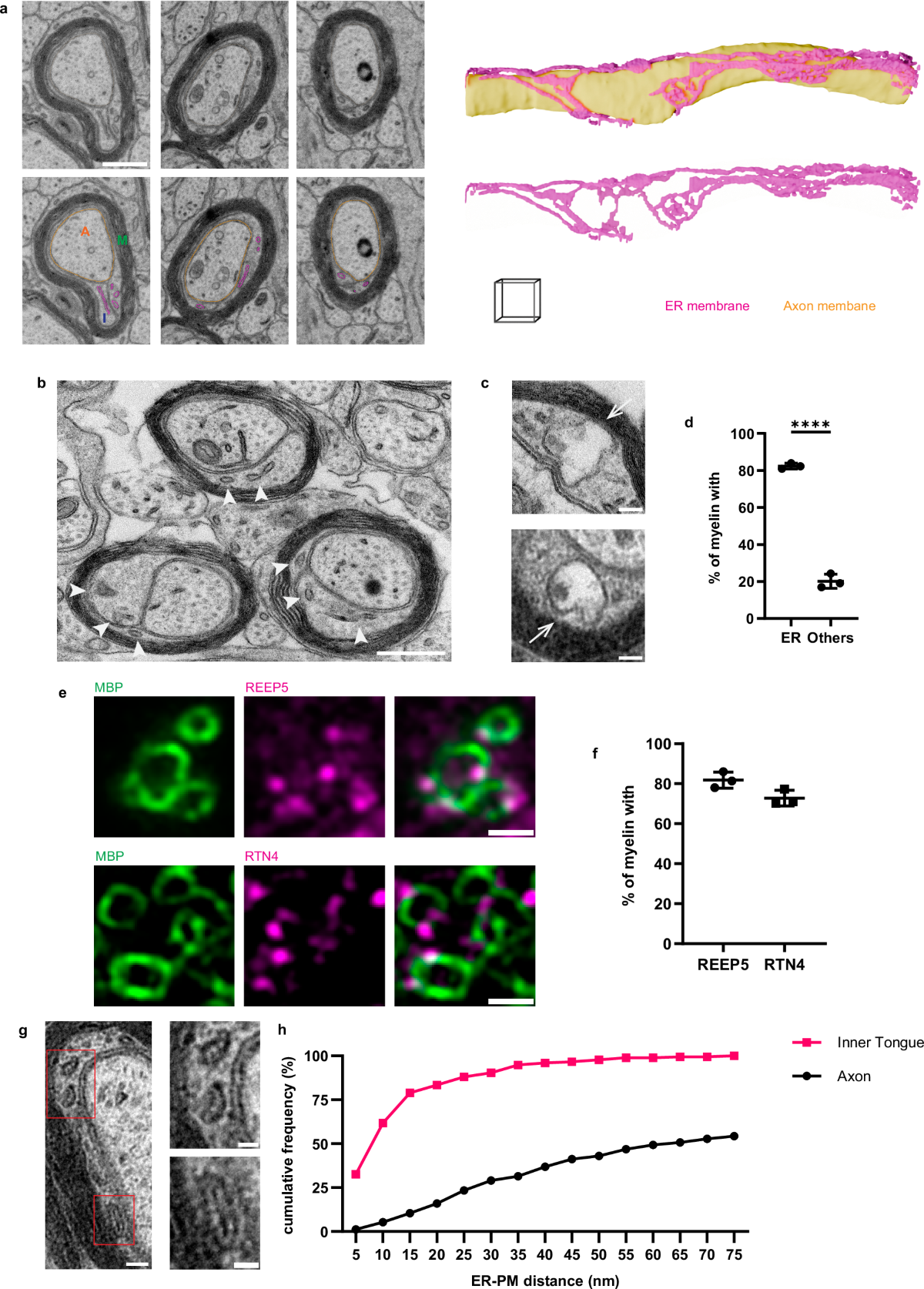 Nonvesicular lipid transfer drives myelin growth in the central nervous  system | Nature Communications